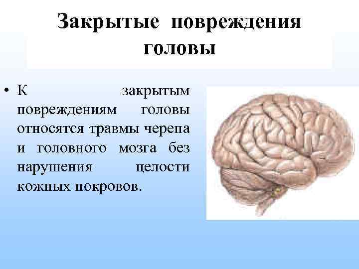 Закрытые повреждения мозга. Травмы головы классификация. Травмы черепа и головного мозга. Закрытые повреждения черепа и головного мозга.