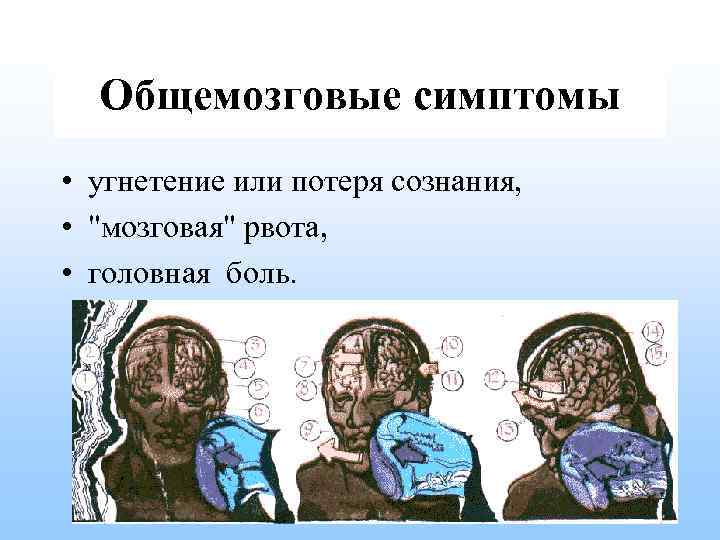 Общемозговые симптомы • угнетение или потеря сознания, • 