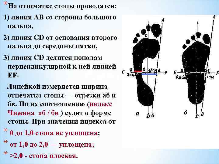 *На отпечатке стопы проводятся: 1) линия АВ со стороны большого пальца, 2) линия СD