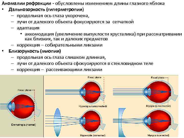 Аномалии рефракции - обусловлены изменением длины глазного яблока • Дальнозоркость (гиперметропия) – продольная ось