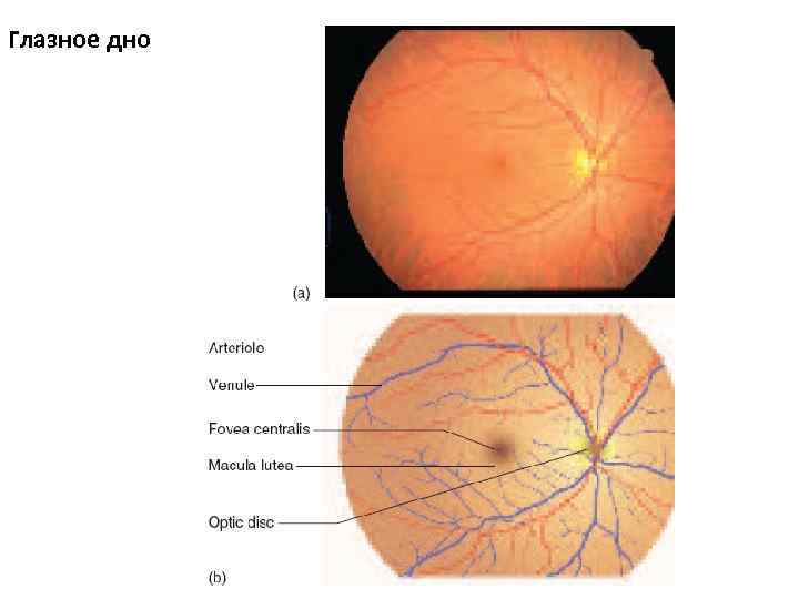 Норма глазного дна. Глазное дно при офтальмоскопии норма. Схема глазного дна норма. Схема глазного дна 2 глаза. Образование глазного дна схема.