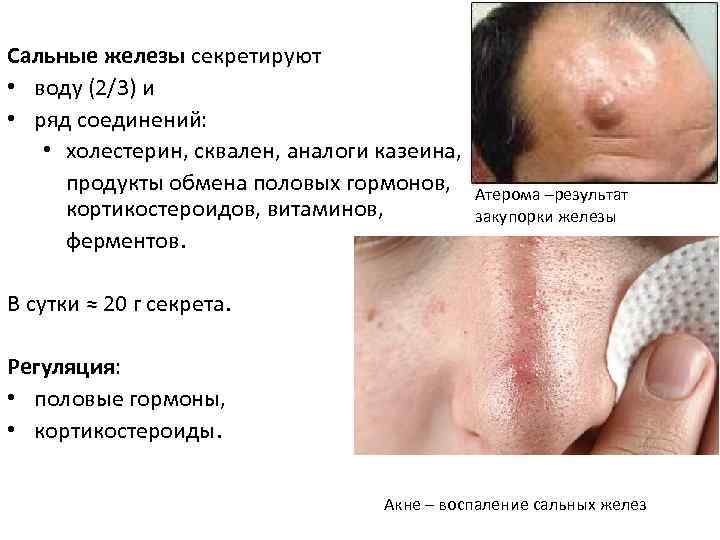 Сальные железы секретируют • воду (2/3) и • ряд соединений: • холестерин, сквален, аналоги