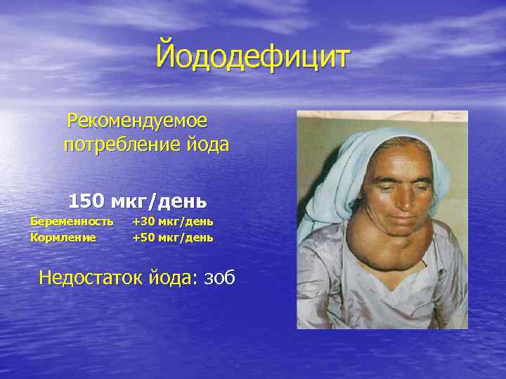 Йододефицит Рекомендуемое потребление йода 150 мкг/день Беременность Кормление +30 мкг/день +50 мкг/день Недостаток йода: