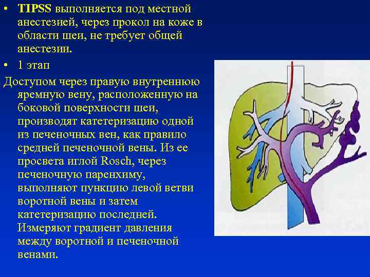 Портальная гипертензия хирургия презентация