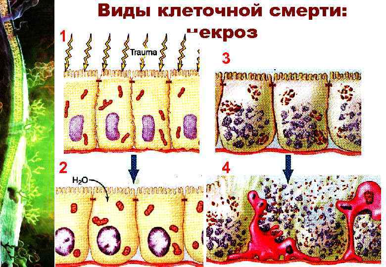 1 Виды клеточной смерти: некроз 3 2 4 27 