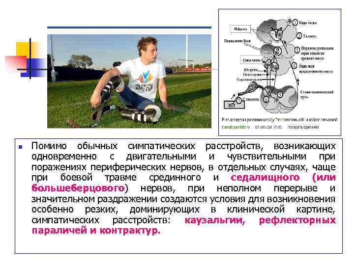 n Помимо обычных симпатических расстройств, возникающих одновременно с двигательными и чувствительными при поражениях периферических