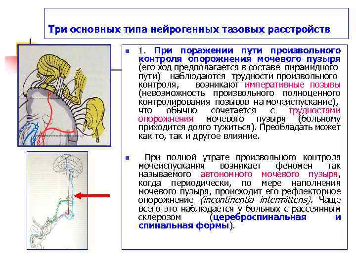 Три основных типа нейрогенных тазовых расстройств n n 1. При поражении пути произвольного контроля