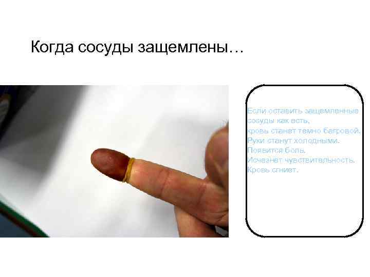 Когда сосуды защемлены… Если оставить защемленные сосуды как есть, кровь станет темно багровой. Руки
