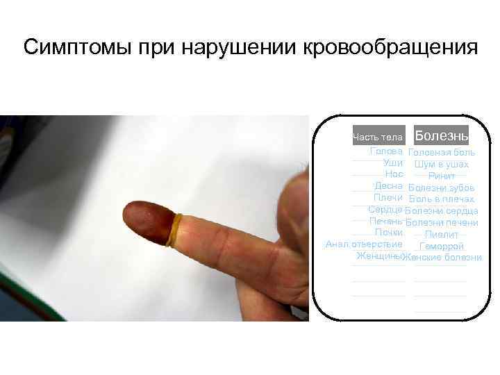Симптомы при нарушении кровообращения Часть тела Болезнь Голова Головная боль Уши Шум в ушах