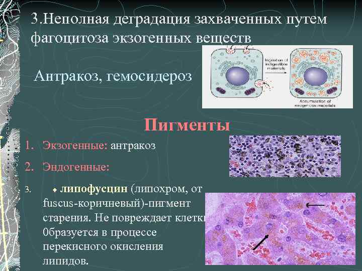 3. Неполная деградация захваченных путем фагоцитоза экзогенных веществ Антракоз, гемосидероз Пигменты 1. Экзогенные: антракоз