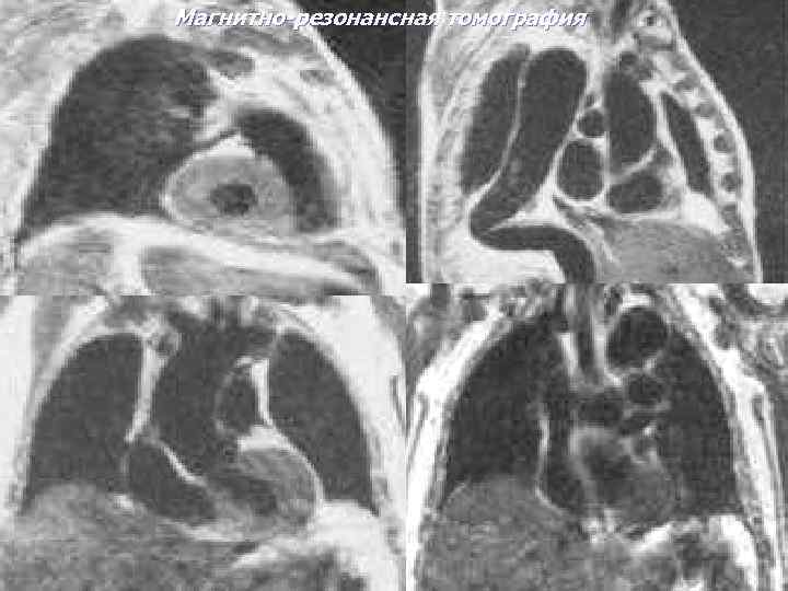 Магнитно-резонансная томография 