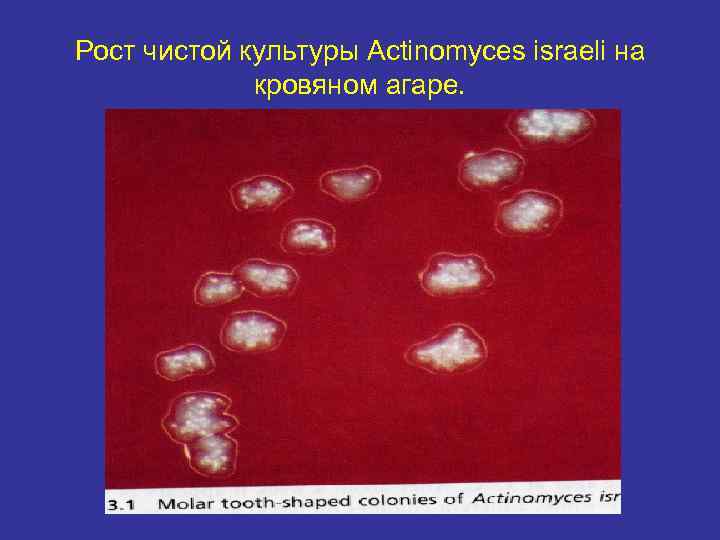 Рост чистой культуры Actinomyces israeli на кровяном агаре. 