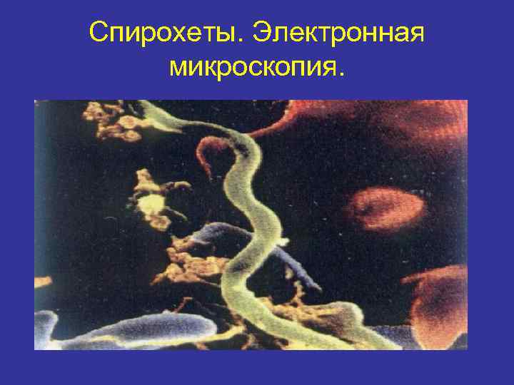 Спирохеты. Электронная микроскопия. 