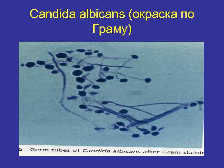 Candida albicans (окраска по Граму) 