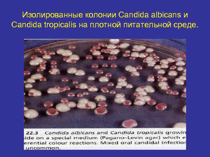 Изолированные колонии Candida albicans и Candida tropicalis на плотной питательной среде. 