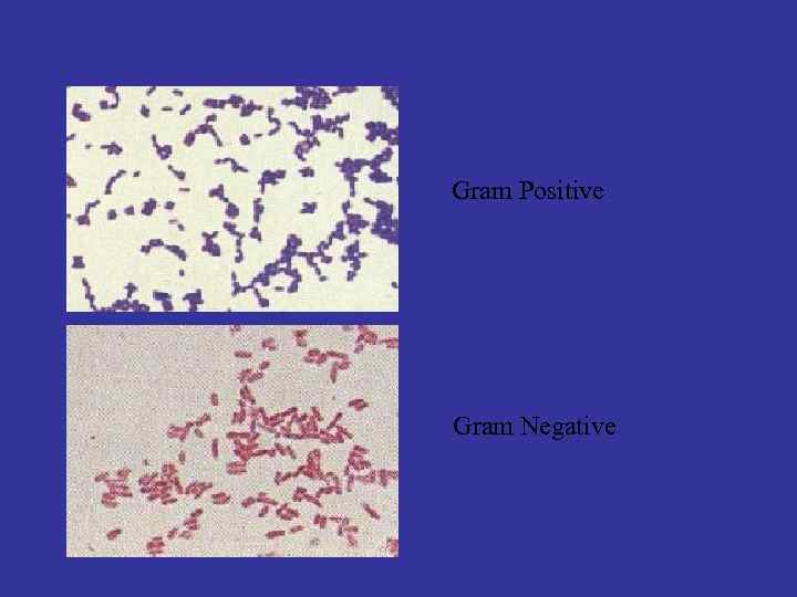 Gram Positive Gram Negative 