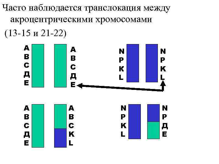 Часто наблюдается транслокация между акроцентрическими хромосомами (13 -15 и 21 -22) А В С