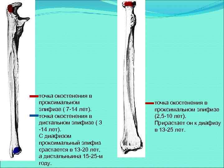 точка окостенения в проксимальном эпифизе ( 7 -14 лет). точка окостенения в дистальном эпифизе