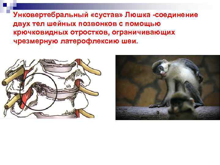 Унковертебральный «сустав» Люшка -соединение двух тел шейных позвонков с помощью крючковидных отростков, ограничивающих чрезмерную