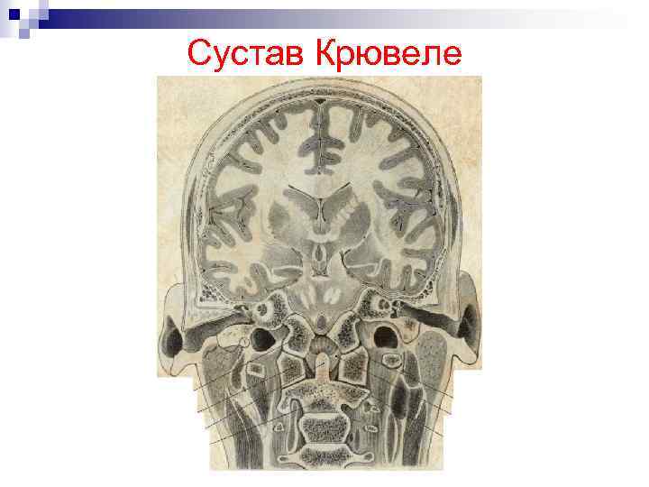 Сустав Крювеле 