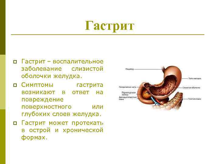 Симптомы гастрита. Симптомы гастрита желудка. Гастрит верхней части желудка. Гастрит это воспалительное заболевание слизистой оболочки желудка. Гастрит сообщение по биологии 8 класс.