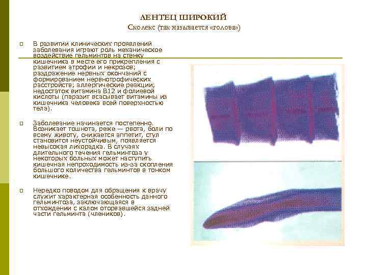 ЛЕНТЕЦ ШИРОКИЙ Сколекс (так называется «голова» ) p В развитии клинических проявлений заболевания играют