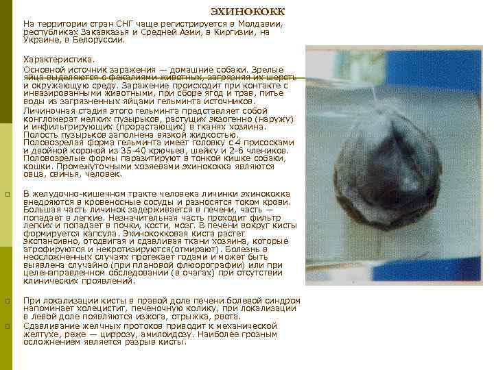 ЭХИНОКОКК p На территории стран СНГ чаще регистрируется в Молдавии, республиках Закавказья и Средней
