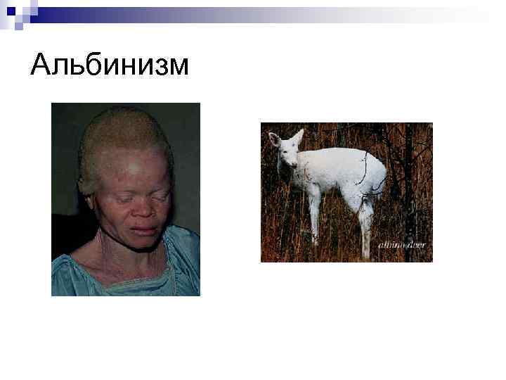 Альбинизм 