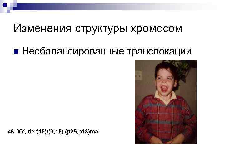 Изменения структуры хромосом n Несбалансированные транслокации 46, XY, der(16)t(3; 16) (p 25; p 13)mat