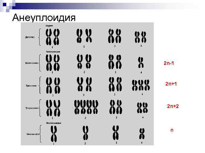 Анеуплоидия по аутосомам. Гетероплоидия моносомия. Гетероплоидия анеуплоидия. Анеуплоидия 21 хромосомы. Анеуплоидия кариотип.