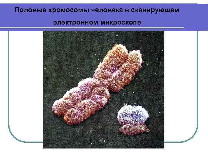 Половые хромосомы человека в сканирующем электронном микроскопе 