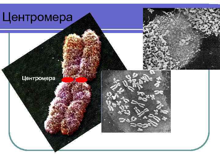 Центромера 
