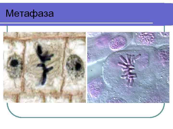 Метафаза 