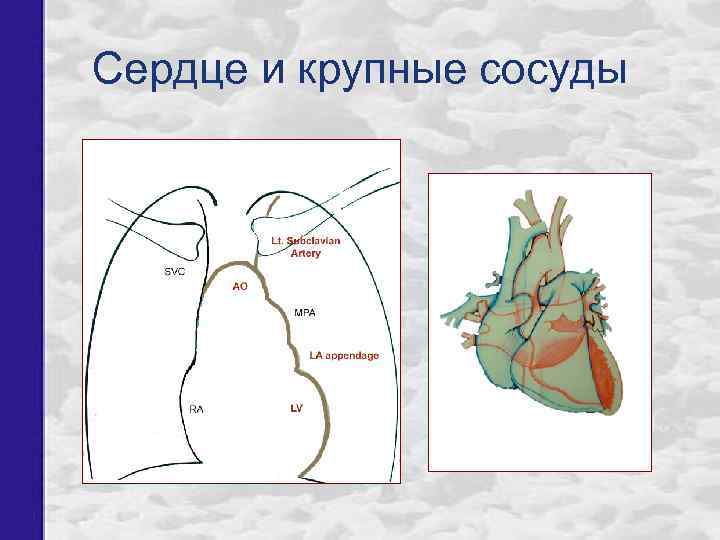 Сердце и крупные сосуды 