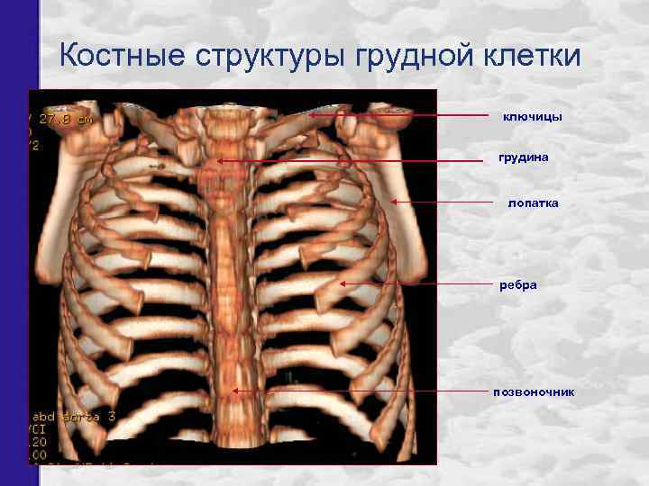 Костные структуры грудной клетки ключицы грудина лопатка ребра позвоночник 