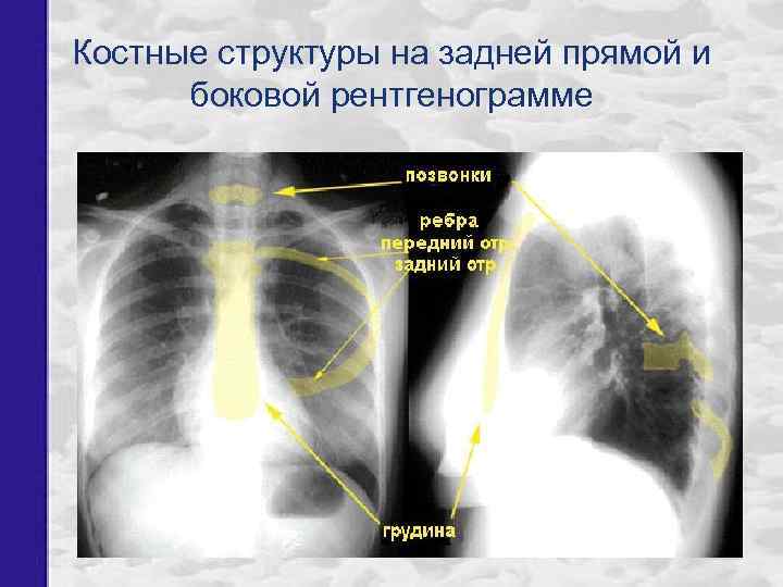 Костные структуры на задней прямой и боковой рентгенограмме 