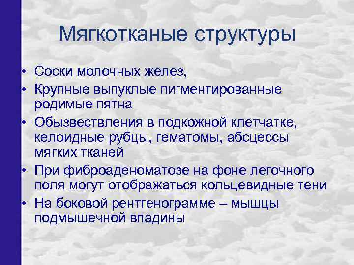 Мягкотканые структуры • Соски молочных желез, • Крупные выпуклые пигментированные родимые пятна • Обызвествления