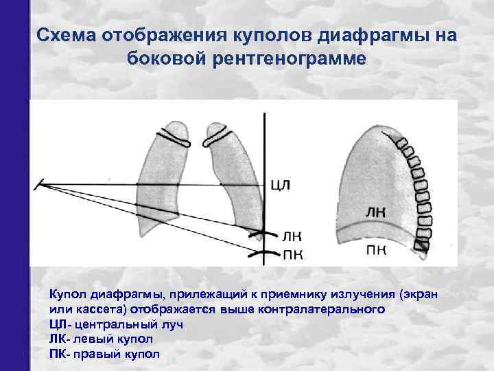 Диафрагма на схеме