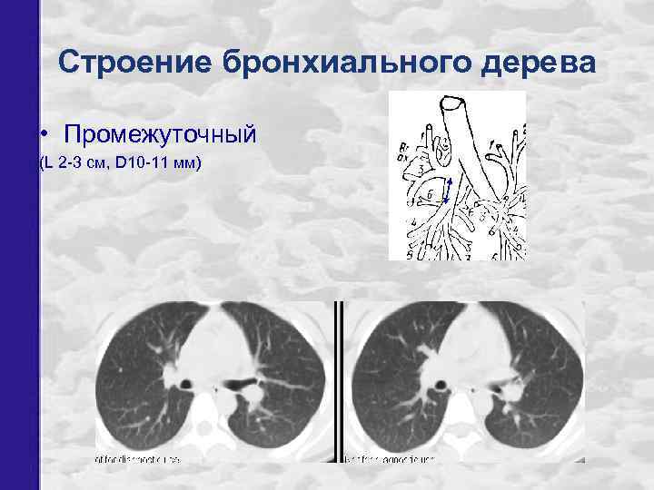 Строение бронхиального дерева • Промежуточный (L 2 -3 см, D 10 -11 мм) 