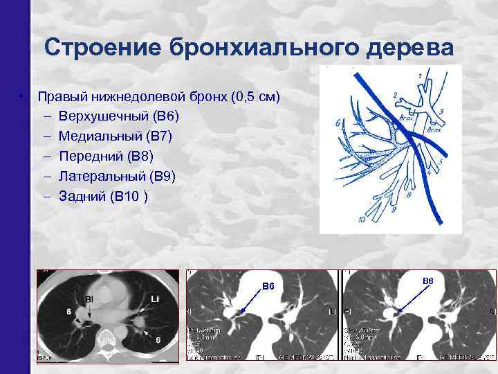 Строение бронхиального дерева • Правый нижнедолевой бронх (0, 5 см) – Верхушечный (В 6)