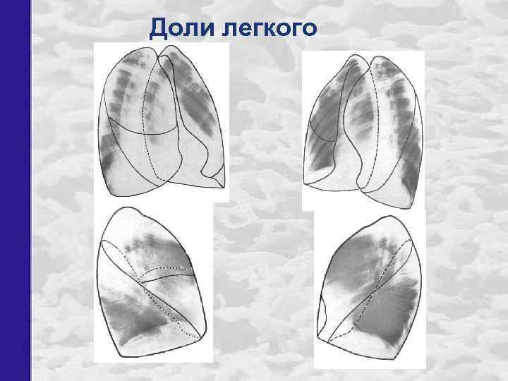 Доли легкого 