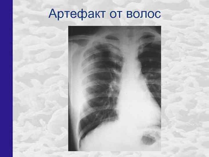 Артефакт от волос 