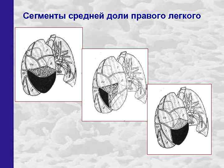 Сегменты средней доли правого легкого 