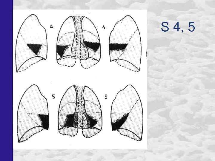 S 4, 5 