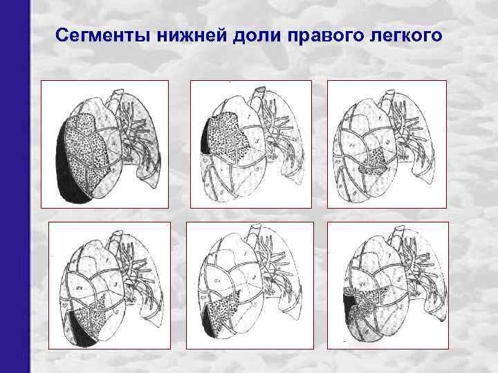 Сегменты нижней доли правого легкого 