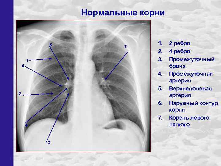 Нормальные корни 5 1 7 1. 2. 3. 6 4. 5. 2 6. 7.