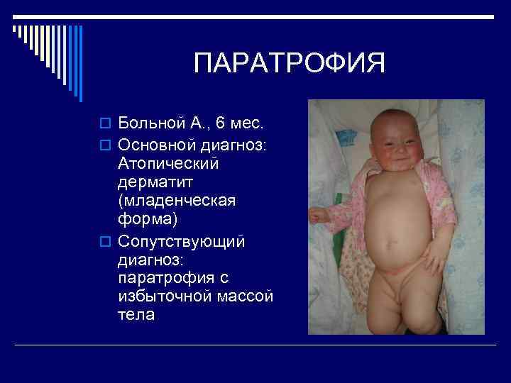 ПАРАТРОФИЯ o Больной А. , 6 мес. o Основной диагноз: Атопический дерматит (младенческая форма)