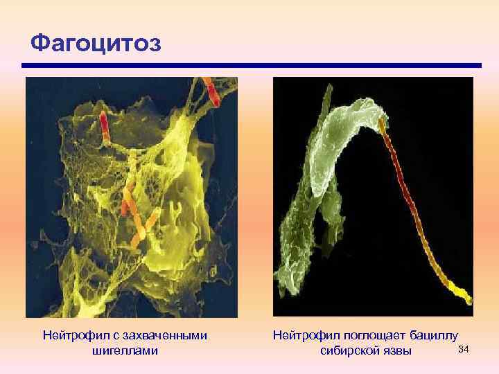Фагоцитоз Нейтрофил с захваченными шигеллами Нейтрофил поглощает бациллу 34 сибирской язвы 