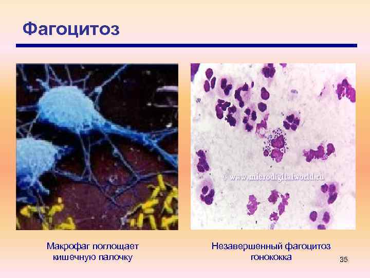 Фагоцитоз Макрофаг поглощает кишечную палочку Незавершенный фагоцитоз гонококка 35 