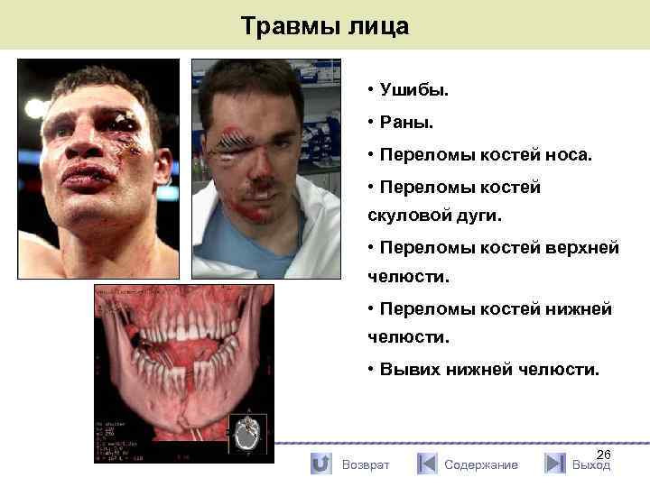 Травмы лица • Ушибы. • Раны. • Переломы костей носа. • Переломы костей скуловой